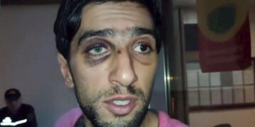 Polislərin işgəncə verməsi ilə bağlı iddiaları DİN-də araşdırılır