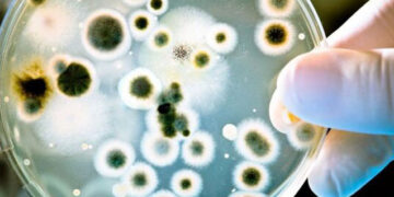 Bədənimizdəki bu nahiyələr mikrobla dolu imiş – Diqqət!