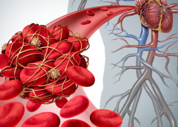 Həkim qanı qatılaşdıran, tromboz yaradan qidalar barədə xəbərdarlıq edib